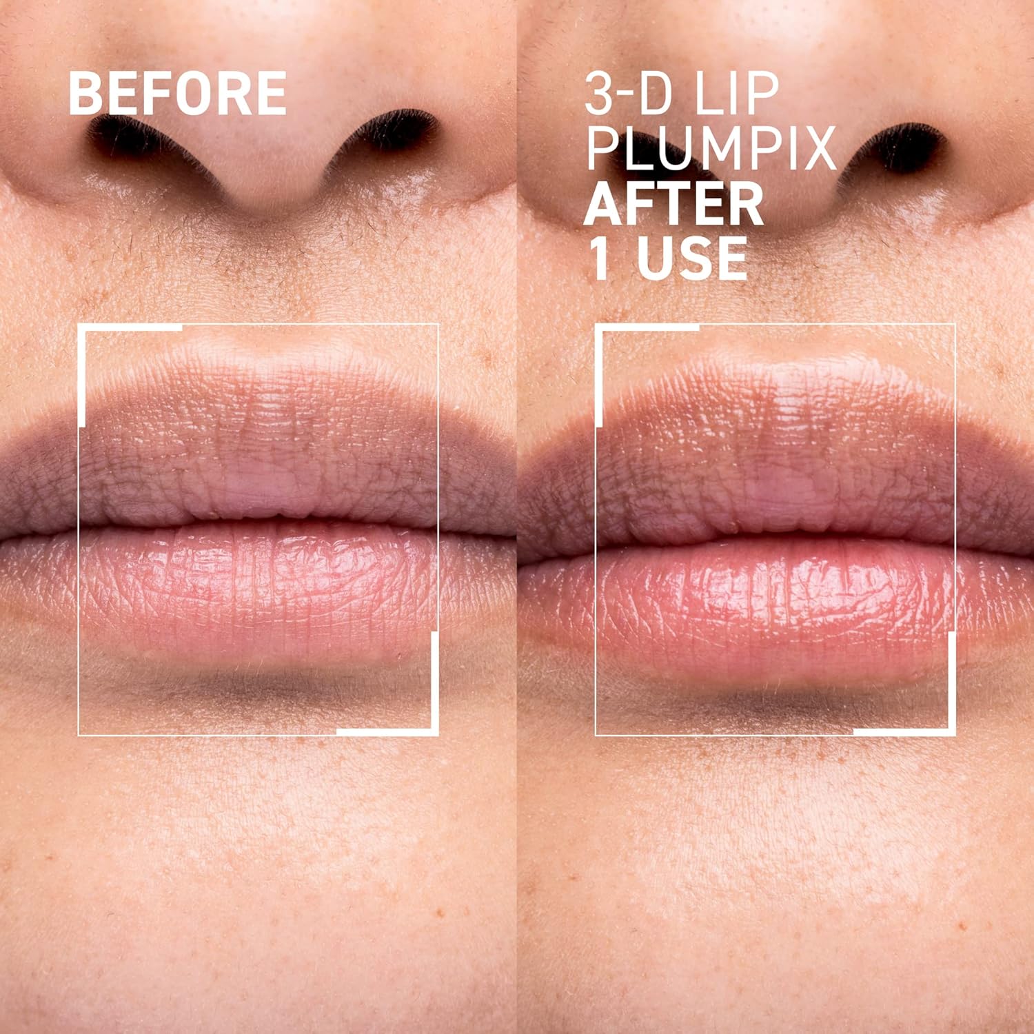 3-D Lip Plumpfix - Image 3