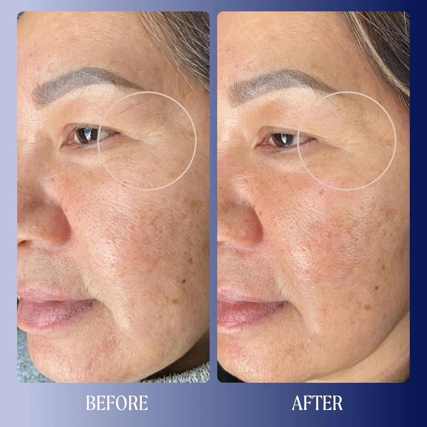 Dreamwave 2% Bio-Retinoid Overnight Renewal Serum - Image 4