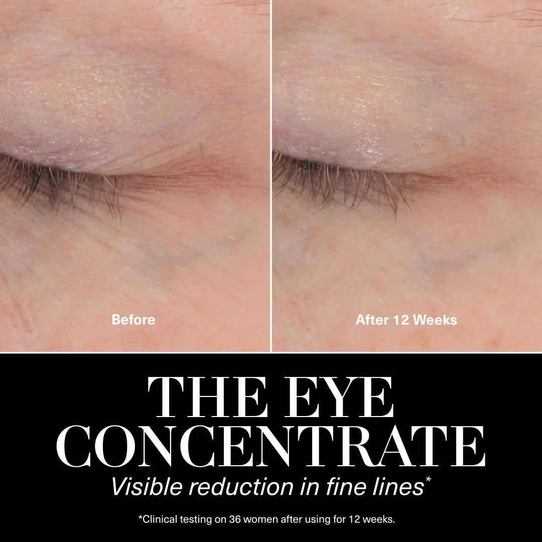 Eye Concentrate - Image 7
