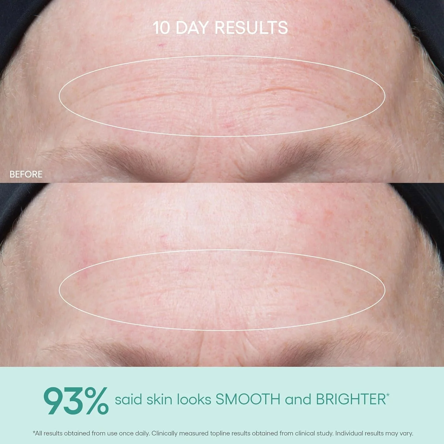 Genius Ultimate Anti-Aging Vitamin C+ Serum - Image 4