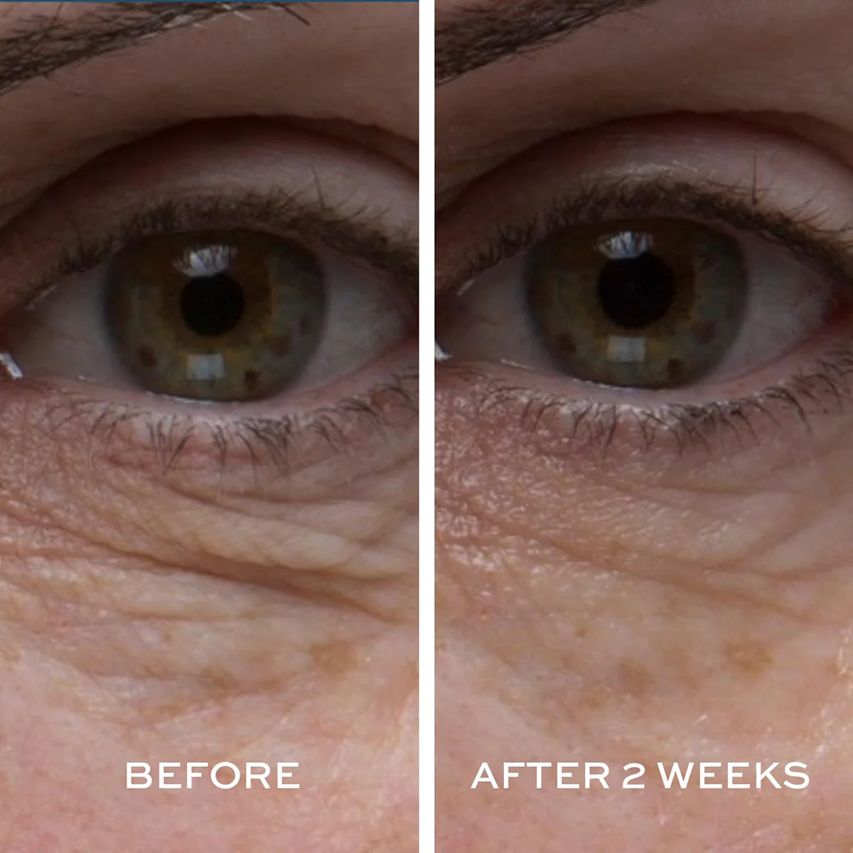 Peptide4 Eye Recovery Cream - Image 4