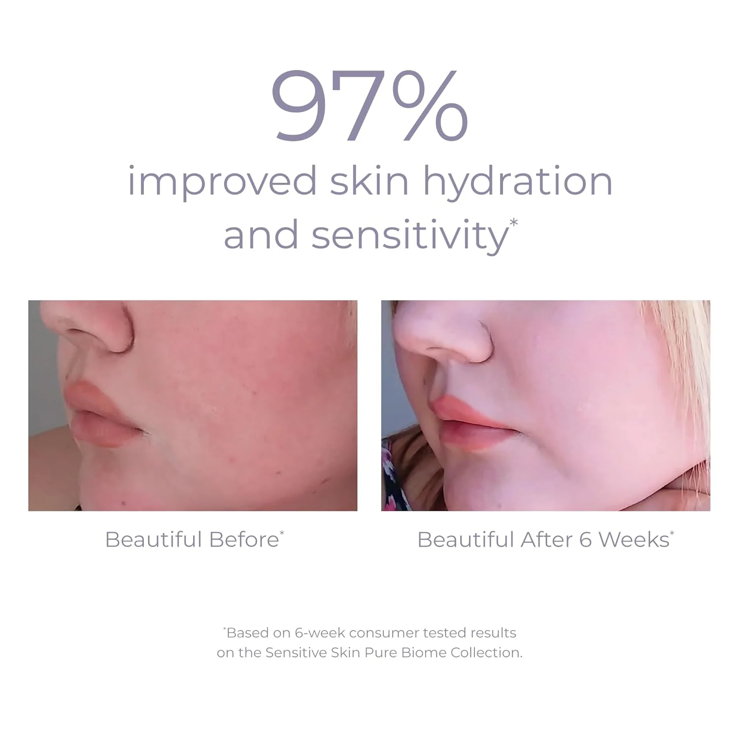Pure Biome Balancing Serum - Image 3