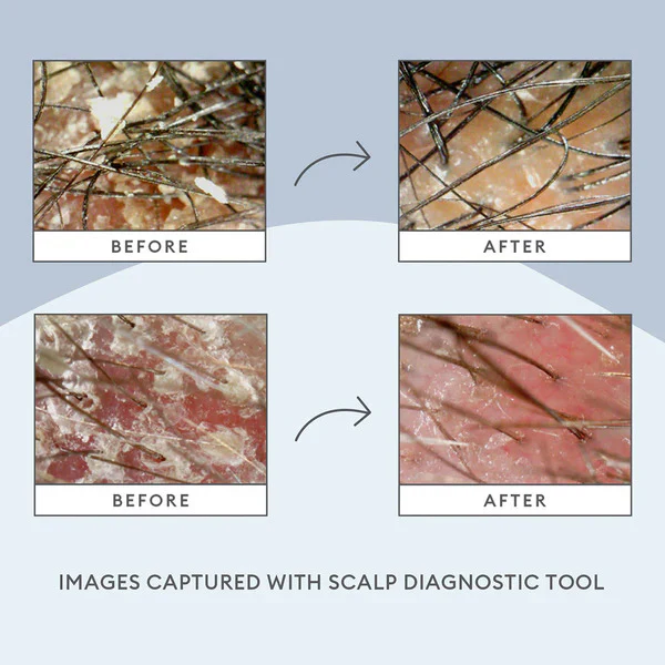 Scalp Revival Soothing Solutions Value Set - Image 2
