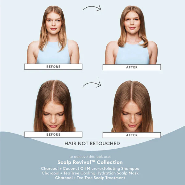 Scalp Revival Soothing Solutions Value Set - Image 4