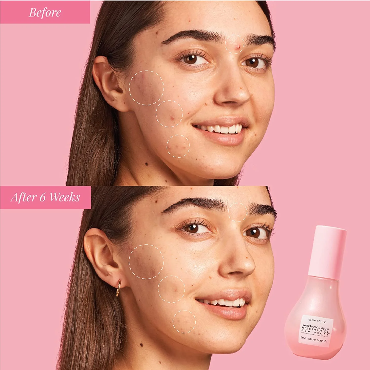 Watermelon Mini Niacinamide Dew Drops Serum - Image 4